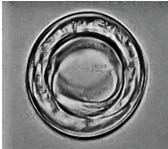 Fig. 27 a, b y c. flexión vulvar Fig. 28 a y b. 4.3 Romanomermis wuchangensis. (Rw). 4.3.1 Huevos Huevos esféricos a aplanados en los polos (fig.