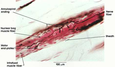 Huso muscular Corte transverso a través de un huso, donde se ven son racimos de
