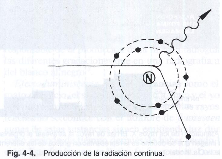 Cuando se aplica un alto voltaje entre el cátodo y el ánodo, los electrones son acelerados por la diferencia de potencial entre ellos, y al chocar contra el blanco se producen los Rayos X de alguna