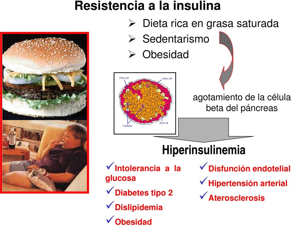 Hiperinsulinemia Intolerancia a la glucosa Diabetes tipo 2