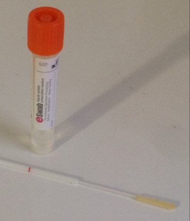 PCR a tiempo real. Qué se necesita? 1. Disponer de hisopos adecuados para la toma de frotis nasofaríngeos (FNF). 2. Realizar una toma de muestra adecuada. 3.