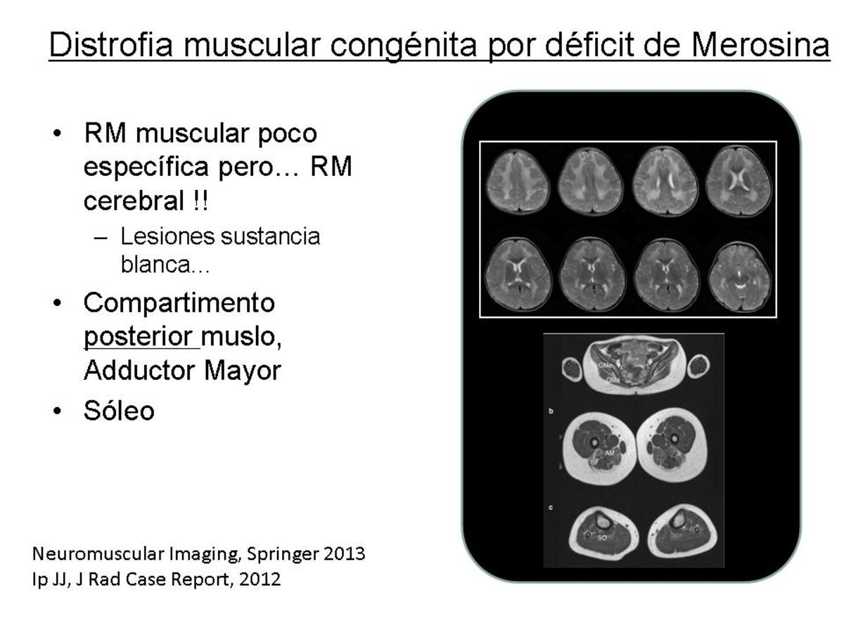 Fig. 32 Referencias: Neuromuscular Imaging,