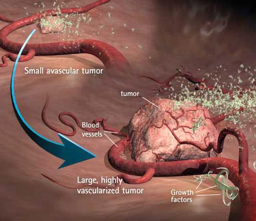 Cómo se propaga un cáncer? Tumor: Masa celular procedente de una división incontrolada.