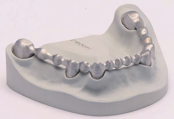 El colado de precisión dental realizado con la técnica de proceso sistémica según bredent La precisión del ajuste de la construcción primaria es fundamental para la base de la construcción secundaria.