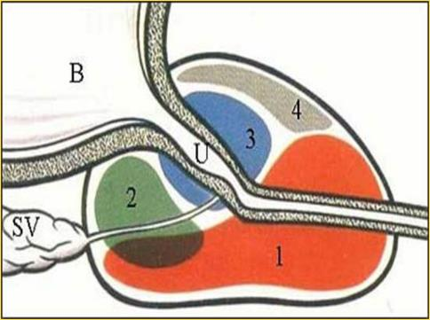Para comprender un poco más la anatomía zonal de la próstata utilizaremos el modelo tridimensional de Mcneal que tiene como punto de referencia la uretra y es el que mejor se correlaciona con los