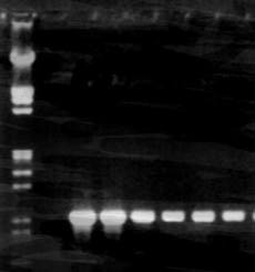 1 2 3 5 6 7 8 938 pb Fig. 13: Electroforesis de los amplificados de la PCR para bla TEM. Carril 1, marcador de peso molecular (Marker III, Roce). Carril 2, control negativo E.