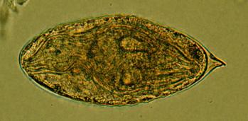 Trematodos: ciclo biológico de Schistosoma (bilharzia) Huevo