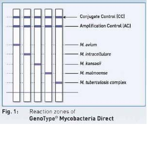 GenoType Mycobacteria Direct Weizenegger M et al. Sensibilidad total MTBC 82.5% (94.
