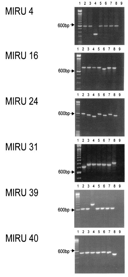 MIRU-VNTR Mycobacterial Interspersed Repetitive Unit Variable Number Tandem Repeat Detección del número de veces que se repiten de forma contigua determinadas