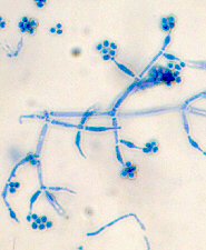 Trichoderma spp Trichoderma spp es un hongo antagonista, que actúa como organismo benéfico impidiendo el desarrollo de hongos o nemátodos causantes de enfermedades en las plantas.