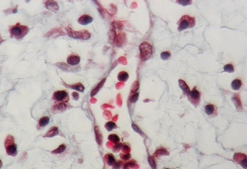 Tejido conjuntivo común: Células propias Este corte muestra tejido conjuntivo laxo.