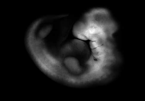 Slide 47 / 135 Desarrollo embrionario humano Desde el principio en el desarrollo embrionario, los seres humanos poseen características que nuestros