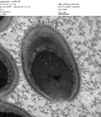 A B Efecto de la saponina Sc-2 de Solanum chrysotrichum sobre levaduras de Candida. albicans. Fig A- Candida albicans célula testigo sin adición de la saponina SC-2. Fig. B Candida albicans + saponina Sc-2 a las 12 horas de incubación.