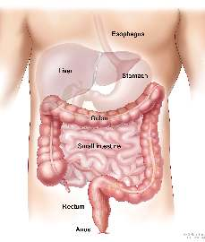 Sobre la enfermedad. El cáncer colorrectal es aquel cáncer que se desarrolla en el cólon (intestino grueso) y/o en el recto.