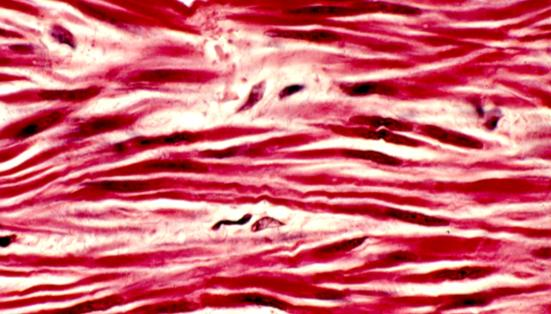 De protección: a) epitelio vaginal y b) córnea. De transporte: c) endotelio de un vaso sanguíneo (VR) y el epitelio de las asas de Henle (TS). d) Membranas o túnicas musculares.