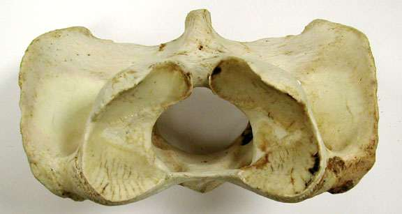 La primera vértebra de la serie cervical Cuerpo vertebral reducido Su morfología está muy modificada y única en la