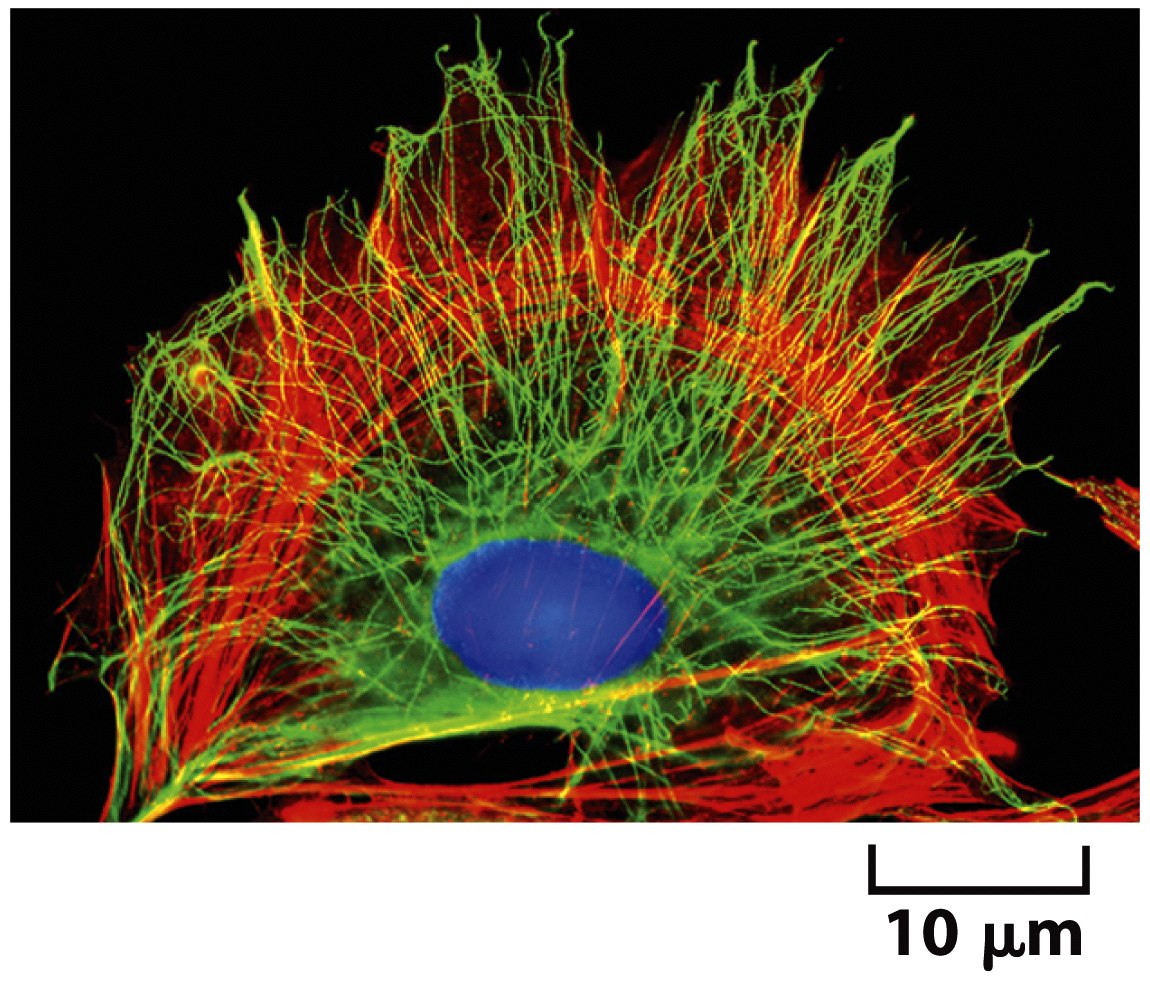 Citoesqueleto y Uniones celulares Microfilamentos (actina) Microtpubulos