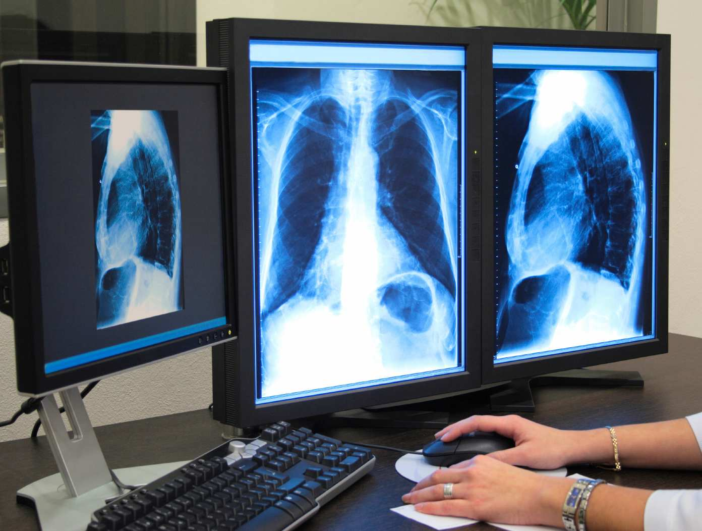 Transición de la radiología convencional a digital Recientemente se han sustituido todos los equipos convencionales radiográficos y fluoroscópicos por técnicas digitales.