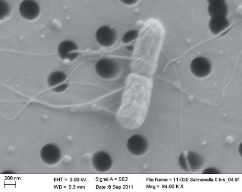 de los casos, con 30%, Campylobacter spp apareció como el segundo agente en prevalencia. Salmonella spp fue hallada sólo en el 5%, E.coli enteropatógena 6%, E.coli enteroinvasiva 1% y finalmente E.