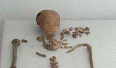 Informe de exhumación de fosa común en Casavieja (Ávila) Marzo de 2009 Estudio antropológico 40 Grado de conservación del material óseo muy deficiente.