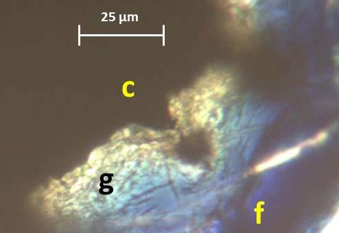 En la Figura 4.3.12 se puede apreciar imágenes de tinciones con azul de toluidina de secciones transversales correspondientes a 1 mes con implante de AZ31 sin recubrimiento de MgF 2.