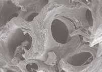 El hueso esponjoso humano está compuesto en más de un 50% por hidroxiapatita (HA): OpteMx es una matriz biocompatible y con propiedades de osteoconducción.