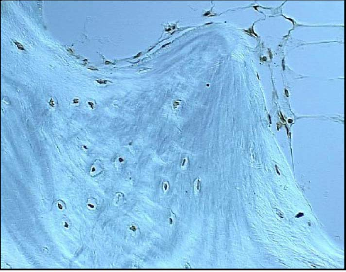 apoptóticos muestran un (tinción incremento marrón de adipocitos +) (inmunohistoquímica con trabéculas para óseas ISEL)
