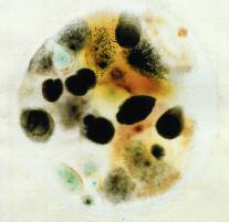 El color de las colonias puede variar desde beige o crema, hasta azul verdoso. Tienen apariencia abultada, es decir, con una tercera dimensión: convexas. Son de color uniforme, no difusas.