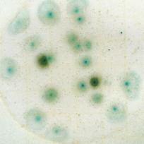 Las colonias de levaduras pueden tomar diversos tonos, desde color beige (como se ve en esta foto) hasta rosa, o color azul verdoso.