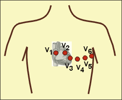 Introducción El electrocardiograma (ECG) es el registro gráfico de la activación eléctrica del corazón.