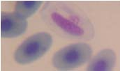 Para el análisis de parásitos hemáticos se pueden realizar extensiones o frotis, gota gruesa, etc. La tinción con colorantes como el Giemsa facilita la detección de los patógenos al microscopio.