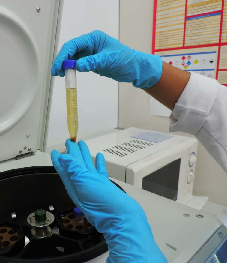 Concentración Para facilitar la detección de protozoos y helmintos en muestras fecales se procede a métodos de concentración.
