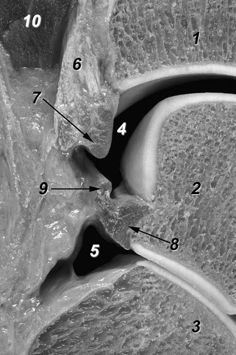 Ligamento tibiofibular posterior o posteroinferior Según descripciones clásicas podemos considerar que está constituido por dos componentes, uno superficial y otro profundo 11, aunque esta
