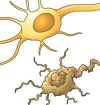 Pero además, dicho proceso es responsable de la severa pérdida neuronal producida en numerosas enfermedades neurodegenerativas (Enfermedad de Alzheimer y Enfermedad de Huntington,