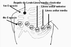 ECG Tipo de derivación Bipolares de Electrodos Definición I = LA RA extremidades (Einthoven) LA, RA, LL, RL II = LL RA III = LL LA avr = RA 0,5 (LA + LL) Aumentadas (Goldberger) Unipolares