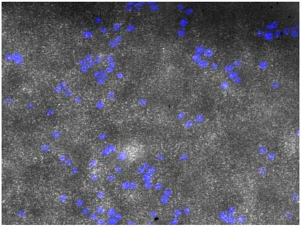 Imágenes 10x de las membranas PLLA-Col con células vivas J774 a 48h