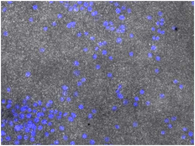 Conjunto de células J774 coloreadas con DAPI sobre membranas de