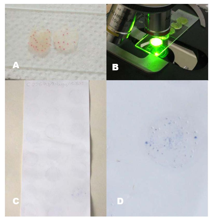 Fuente: Informe de resultados: Detección de Leifsonia xyli subsp. xyli. (Chavarría 2006). A) Tinción de los haces vasculares con Safranina O (THV). B) Observación por autofluorescencia directa (MAFD).