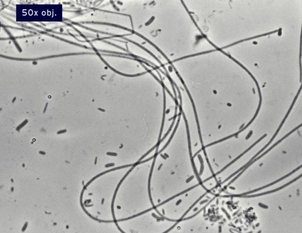 Presencia de bacterias filamentosas Bioindicación microscópica