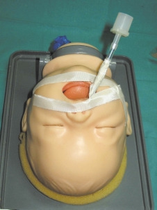 Si el paciente respira espontáneamente puede auscultarse la respiración a la entrada del tubo endotraqueal y por los orificios naturales (boca y narinas).