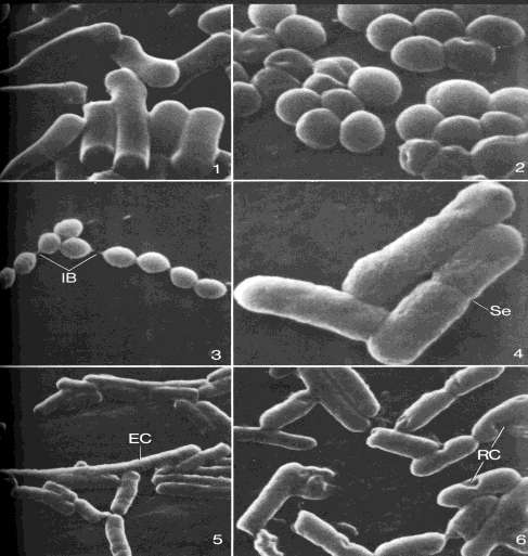 BACTERIAS DE VARIOS GRUPOS 1.- Clostridium 2.- Staphylococcus 3.