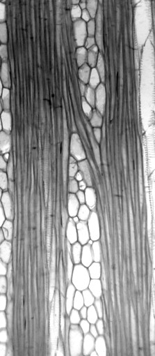 c.fibras: son las células de sostén del xilema y del floema; como ya se explicó, las fibras esclerenquimáticas son células muertas