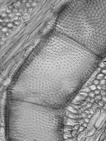 b. Células de reserva: Células de tipo parenquimática axiales (abundantes en ngiospermas y escasas en Gimnospermas). Células de sostén: Son fibras en ngiospermas y fibrotraqueidas en Gimnospermas.