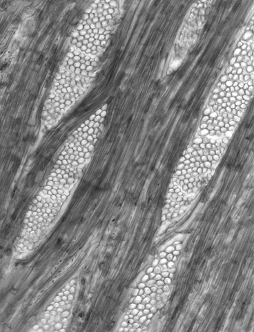 FIRS Cómo se clasifican las fibras del xilema secundario? a.fibras libriformes: Son células más largas que las fibrotraqueidas, con paredes más gruesas. Presentan puntuaciones simples.