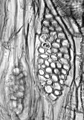 Vaso del xilema rodeado por células parenquimáticas del sistema vertical. Se aprecian también paquetes de fibras y células parenquimáticas radiales con amiloplastos.