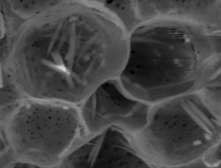 La forma es variable, desde poliédricas, a estrelladas y alargadas. C Células de parénquima.. Microfotografía tomada en ME de parénquima medular; y C.