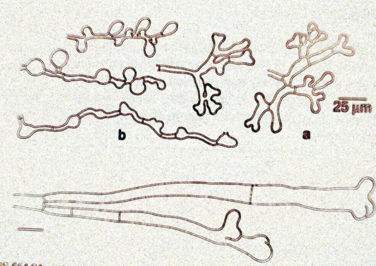 Trichophyton schoenleinii Es un dermatofito antropófilo. Colonias céreas blanquecinas, de crecimiento lento, reverso incoloro.