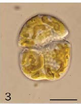 Alrededor del 50% de los dinoflagelados adquieren sus plástidos por endosimbiosis secundarias con una variedad de eucariotas fotosintéticos (como