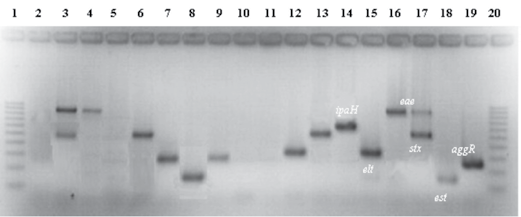 Rev Panam Infectol 2010;12(3):17-21. Figura 1. Electroforesis en gel de agarosa de los productos de amplificación de E. coli diarreogénicas.