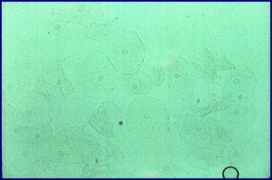 MICROSCOPIO. MICROSCOPIO FOTÓNICO. Estas son células de descamación de la mucosa oral.